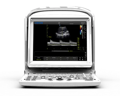 фото УЗИ аппарат CHISON ECO 3 Expert