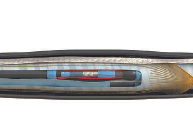 фото Муфта 3ПСТ 10 150/240