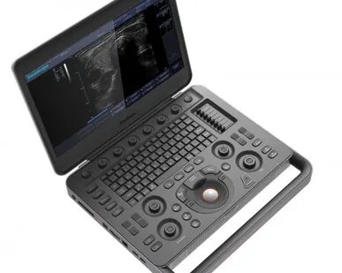 фото Ультразвуковой аппарат SonoScape S2N