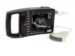 фото AcuVista RS880b портативный узи сканер