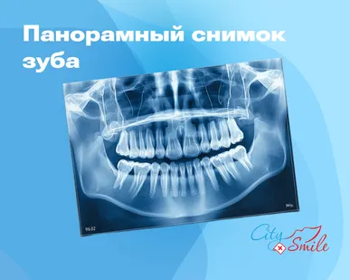 фото Снимок зубов