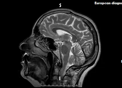 Фото №0 Результат исследования пациента на пленке