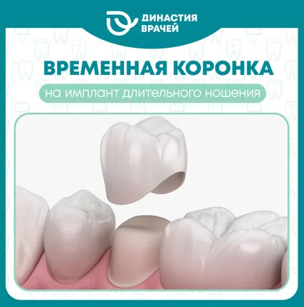 Фото №0 Временная коронка на имплант длительного ношения