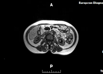 Фото №0 Контрастное усиление Примовист®, включает 10 мл контрастного вещества