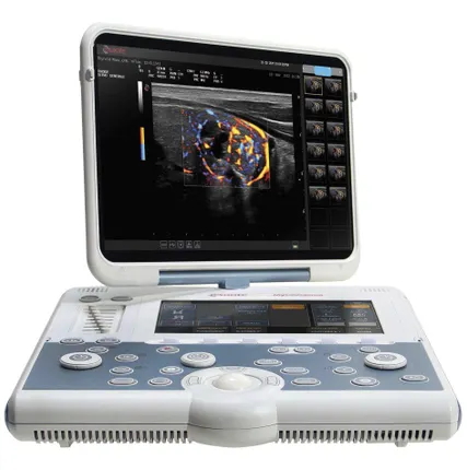 Фото №0 УЗИ аппарат Esaote MyLab Gamma