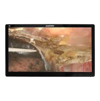 Фото №0 Монитор LCD эндоскопический-хирургический EVORAY S3281P