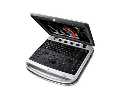 фото УЗИ аппарат CHISON SonoBook 8