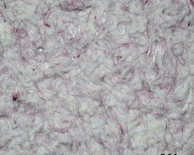 фото Шелковая штукатурка Silk Plaster (жидкие обои) Оптима 061
