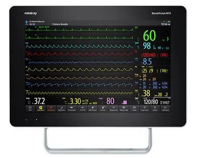 фото Монитор пациента Mindray BeneVision N19