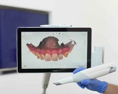 фото Внутриротовое 3D-сканирование