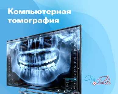 фото КТ зубов