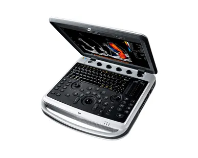 фото УЗИ аппарат CHISON SonoBook 9