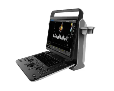 фото Портативный УЗИ аппарат Chison SonoTouch 60 Pro