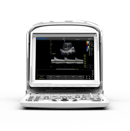Фото №0 УЗИ аппарат CHISON ECO 3 Expert