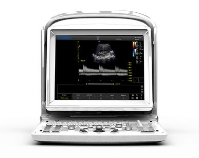 фото УЗИ аппарат CHISON ECO 3 Expert