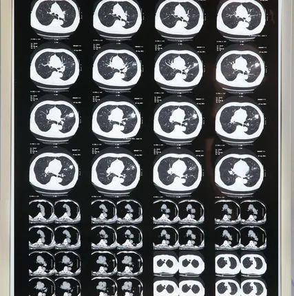 Фото №0 Негатоскоп однокадровый