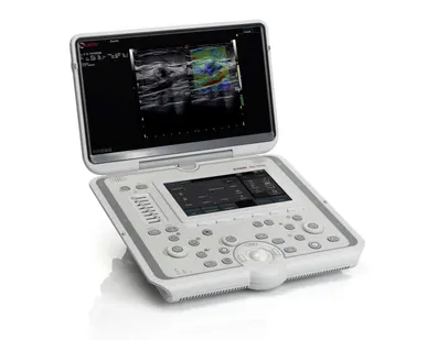 фото УЗИ аппарат Esaote MyLab Omega