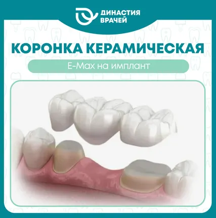 Фото №0 Коронка керамическая E-Max на имплант
